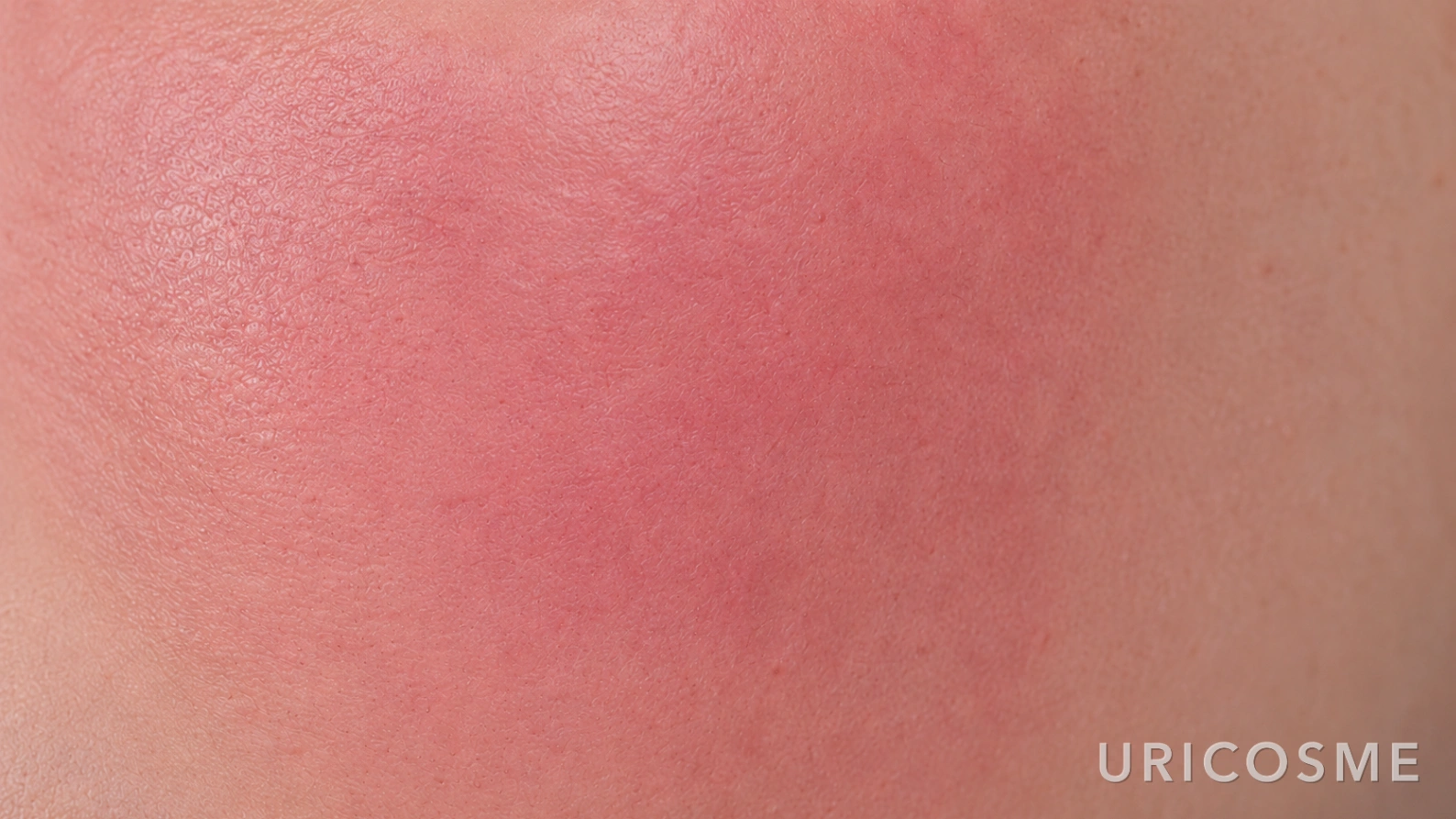 Azulene benefits and how to use it for sensitive skin - 2